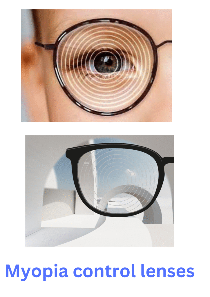 Myopia control lenses